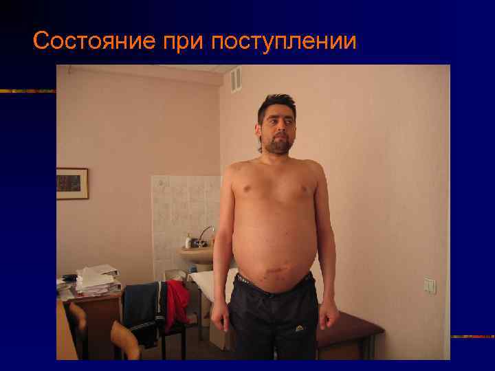 Состояние при поступлении 