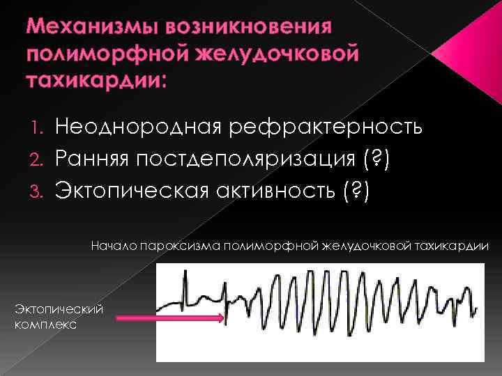 Механизмы возникновения полиморфной желудочковой тахикардии: Неоднородная рефрактерность 2. Ранняя постдеполяризация (? ) 3. Эктопическая