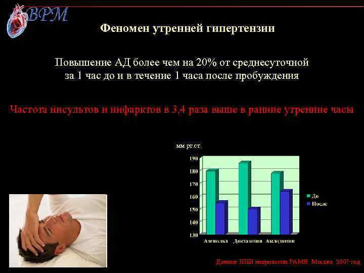 Феномен утренней гипертензии Повышение АД более чем на 20% от среднесуточной за 1 час