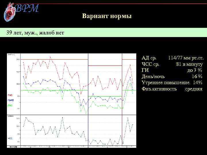 Вариант нормы 39 лет, муж. , жалоб нет АД ср. 114/77 мм рт. ст.