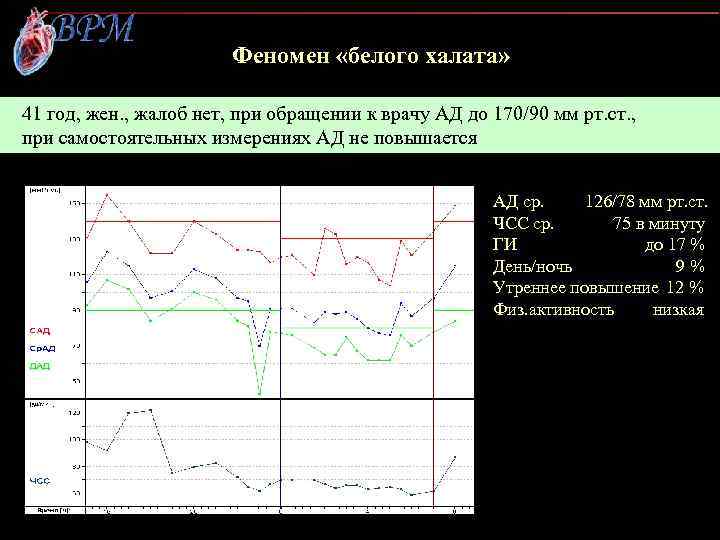 Феномен «белого халата» 41 год, жен. , жалоб нет, при обращении к врачу АД