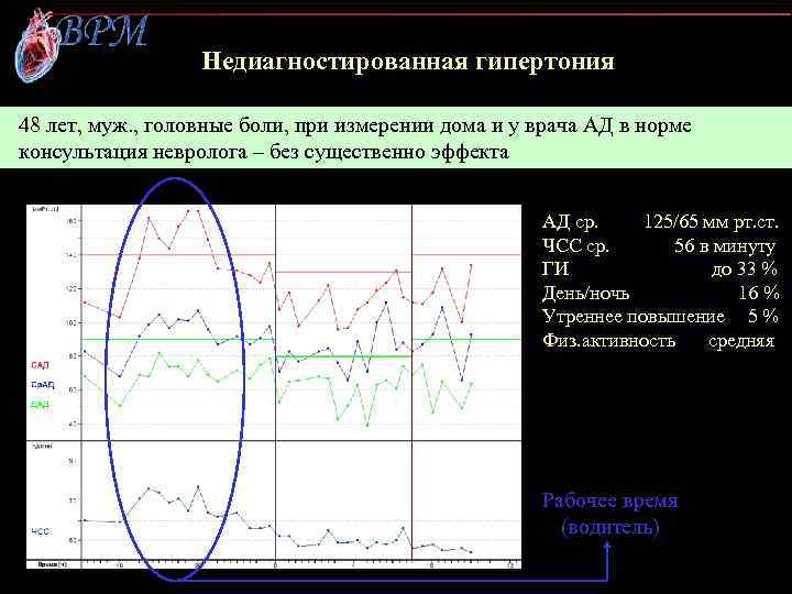 Недиагностированная гипертония 48 лет, муж. , головные боли, при измерении дома и у врача