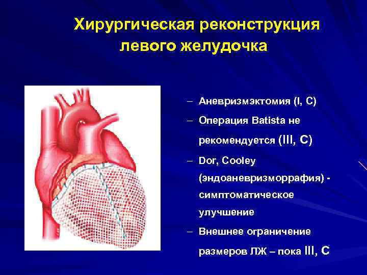 Картине истинной аневризмы в области верхушки миокарда левого желудочка соответствует