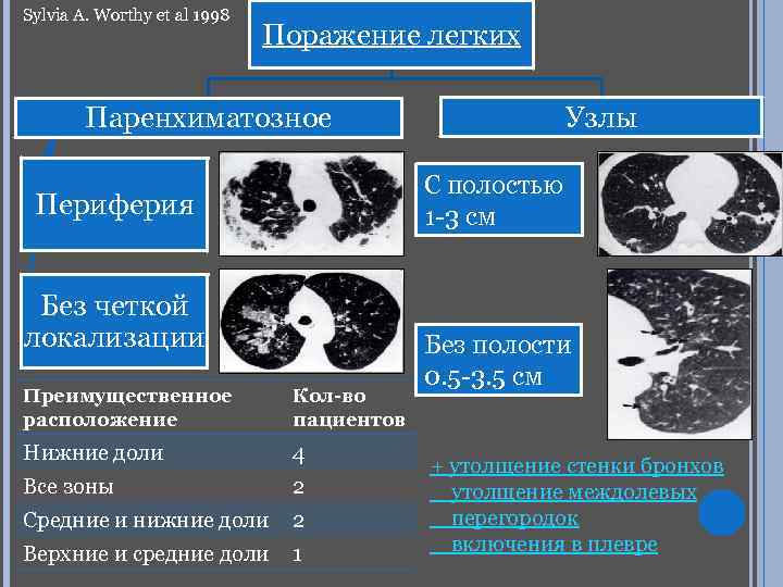 Sylvia A. Worthy et al 1998 Поражение легких Узлы Паренхиматозное С полостью 1 -3