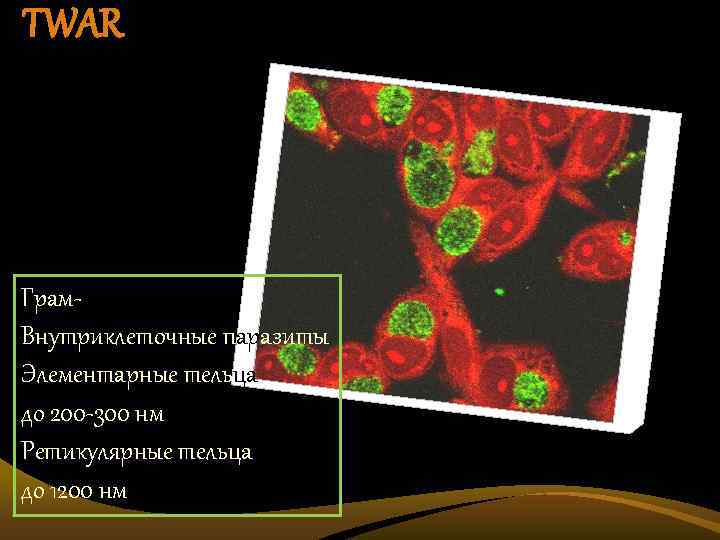 TWAR Грам. Внутриклеточные паразиты Элементарные тельца до 200 -300 нм Ретикулярные тельца до 1200