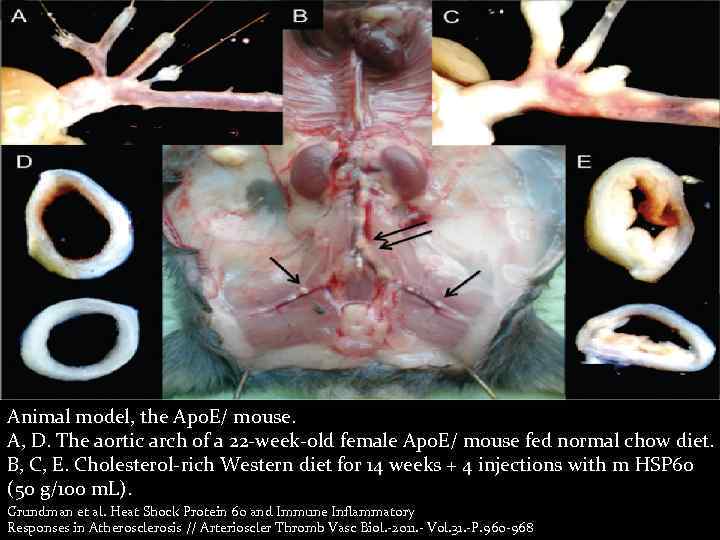 Animal model, the Apo. E/ mouse. A, D. The aortic arch of a 22