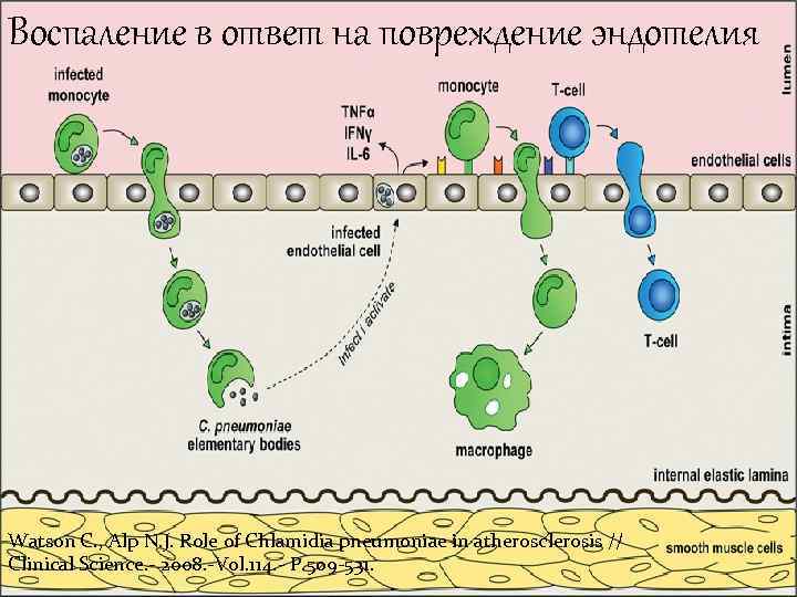 Воспаление в ответ на повреждение эндотелия Watson C. , Alp N. J. Role of