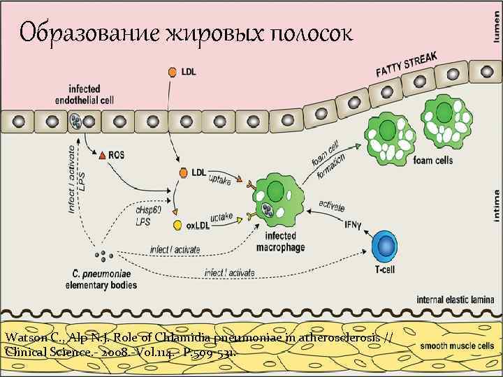 Образование жировых полосок Watson C. , Alp N. J. Role of Chlamidia pneumoniae in