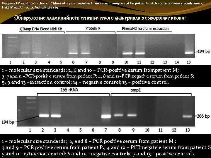 Petyaev IM et al. Isolation of Chlamydia pneumoniae from serum samples of he patients