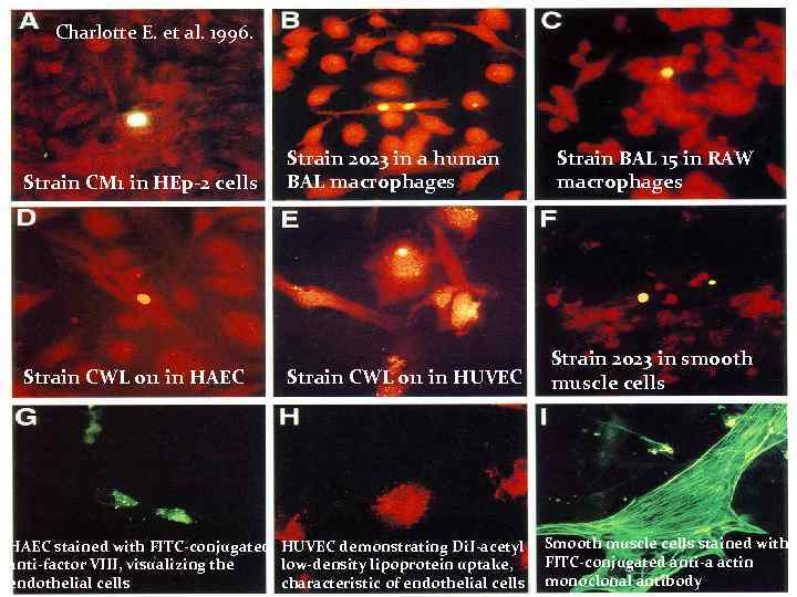 Charlotte E. et al. 1996. Strain CM 1 in HEp-2 cells Strain CWL 011