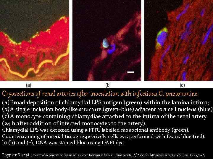 Cryosections of renal arteries after inoculation with infectious C. pneumoniae: (a) Broad deposition of