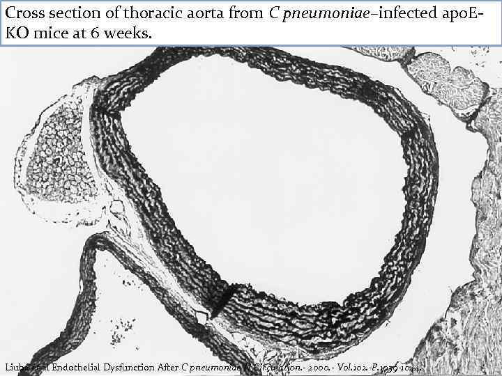 Cross section of thoracic aorta from C pneumoniae–infected apo. EKO mice at 6 weeks.