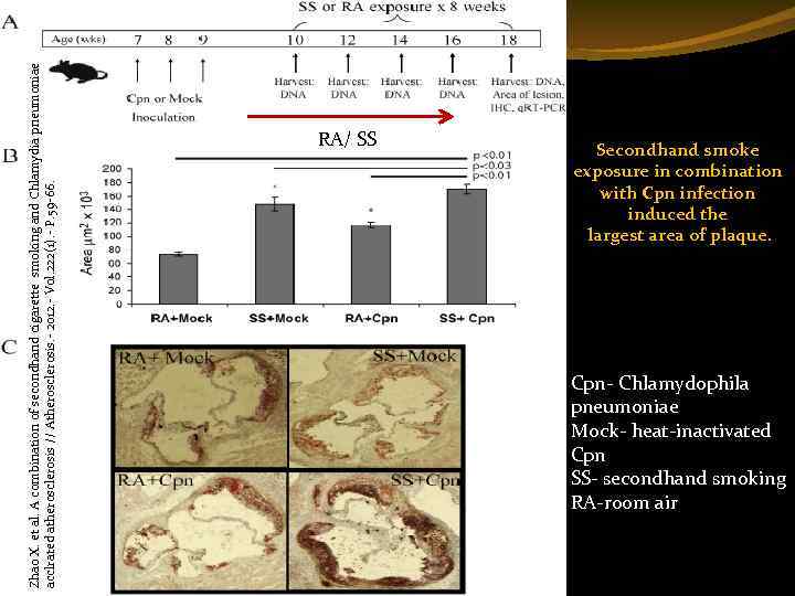 Zhao X. et al. A combination of secondhand cigarette smoking and Chlamydia pneumoniae acclrated