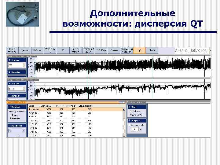 Дополнительные возможности: дисперсия QT 