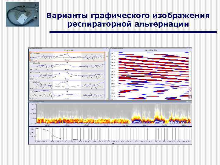 Варианты графического изображения респираторной альтернации 