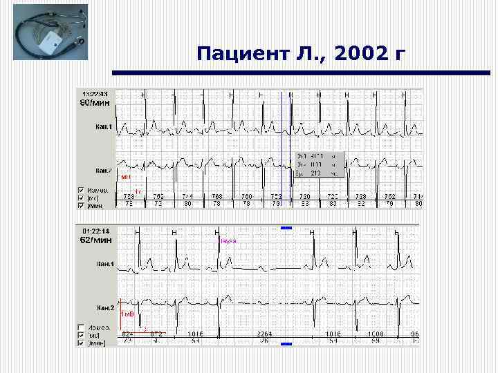 Пациент Л. , 2002 г 