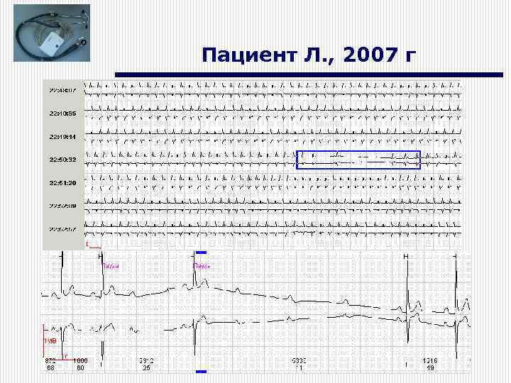 Пациент Л. , 2007 г 