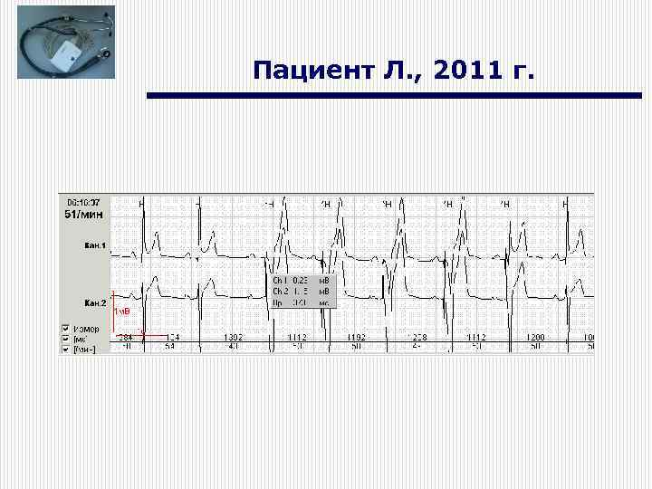 Пациент Л. , 2011 г. 