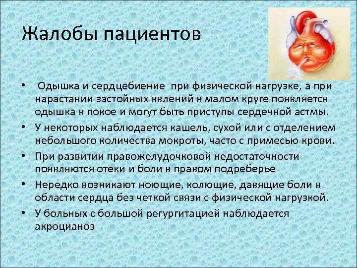 Жалобы пациентов • Одышка и сердцебиение при физической нагрузке, а при нарастании застойных явлений