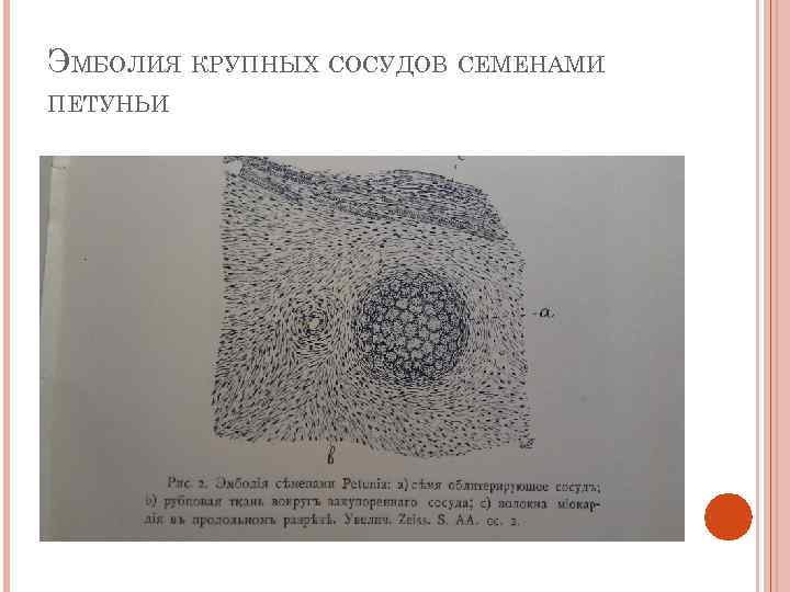 ЭМБОЛИЯ КРУПНЫХ СОСУДОВ СЕМЕНАМИ ПЕТУНЬИ 