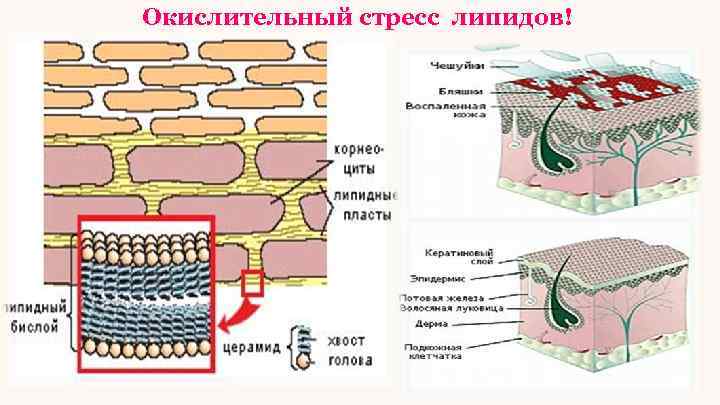 Окислительный стресс липидов! 