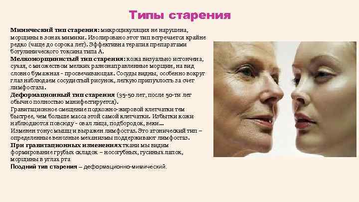 Типы старения Мимический тип старения: микроцикуляция не нарушена, морщины в зонах мимики. Изолировано этот