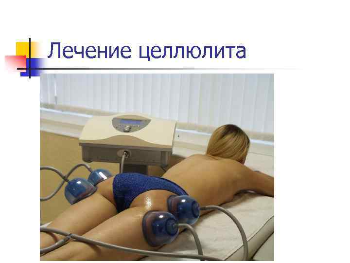 Лечение целлюлита 