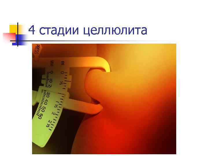 4 стадии целлюлита 