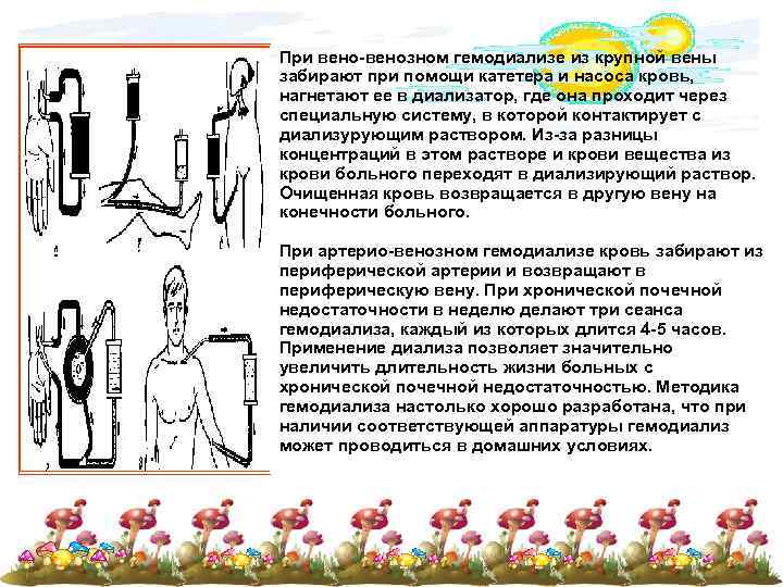 При вено-венозном гемодиализе из крупной вены забирают при помощи катетера и насоса кровь, нагнетают