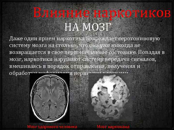 головной мозг и приеме наркотиков
