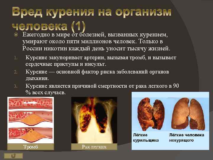  1. 2. 3. Ежегодно в мире от болезней, вызванных курением, умирают около пяти
