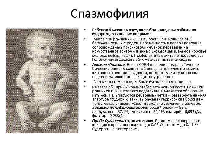 Спазмофилия • • • Ребенок 6 месяцев поступил в больницу с жалобами на судороги,