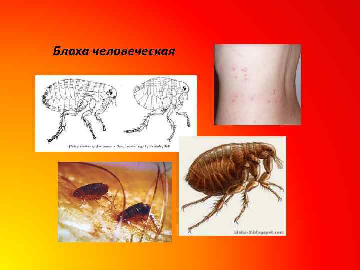 Блоха человеческая 