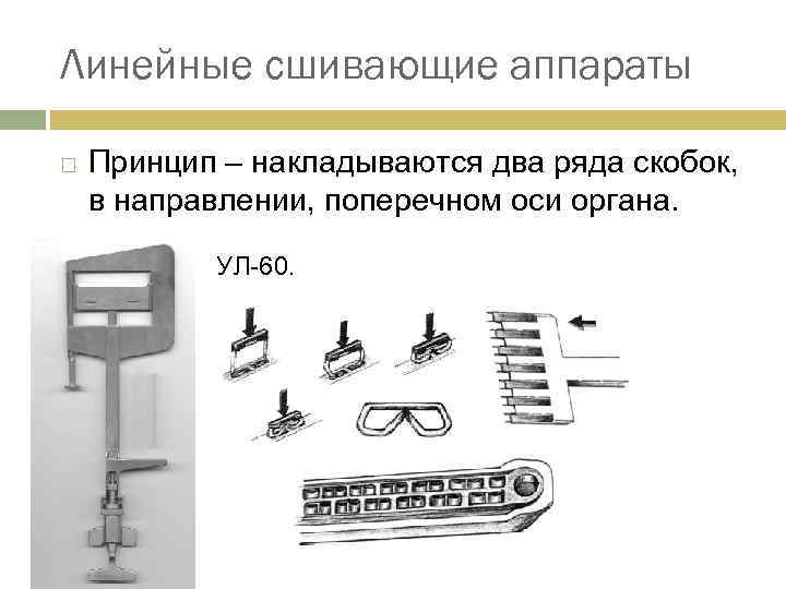 Линейные сшивающие аппараты Принцип – накладываются два ряда скобок, в направлении, поперечном оси органа.