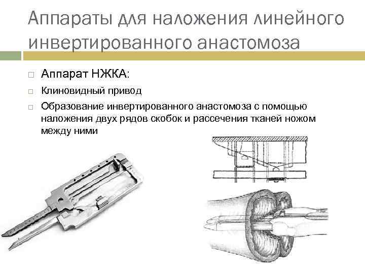 Аппараты для наложения линейного инвертированного анастомоза Аппарат НЖКА: Клиновидный привод Образование инвертированного анастомоза с