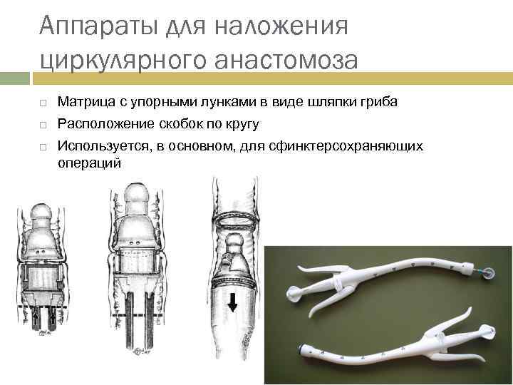 Аппараты для наложения циркулярного анастомоза Матрица с упорными лунками в виде шляпки гриба Расположение