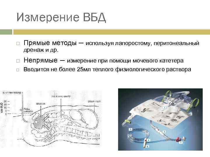 Прямой метод используется для