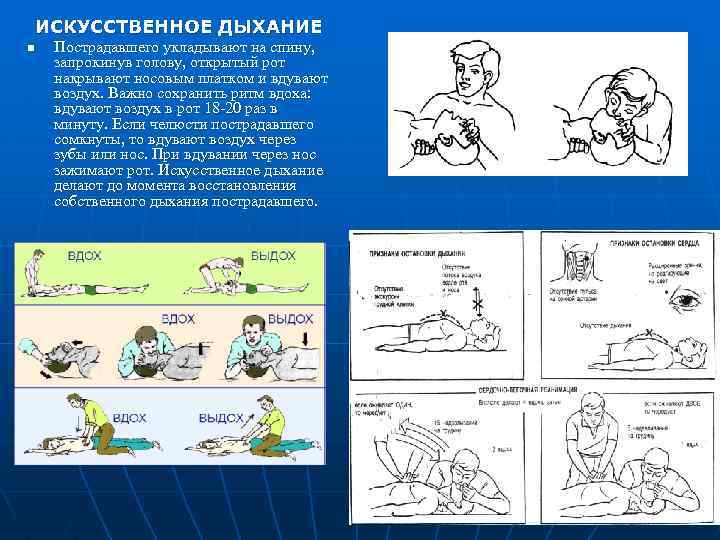 ИСКУССТВЕННОЕ ДЫХАНИЕ n Пострадавшего укладывают на спину, запрокинув голову, открытый рот накрывают носовым платком