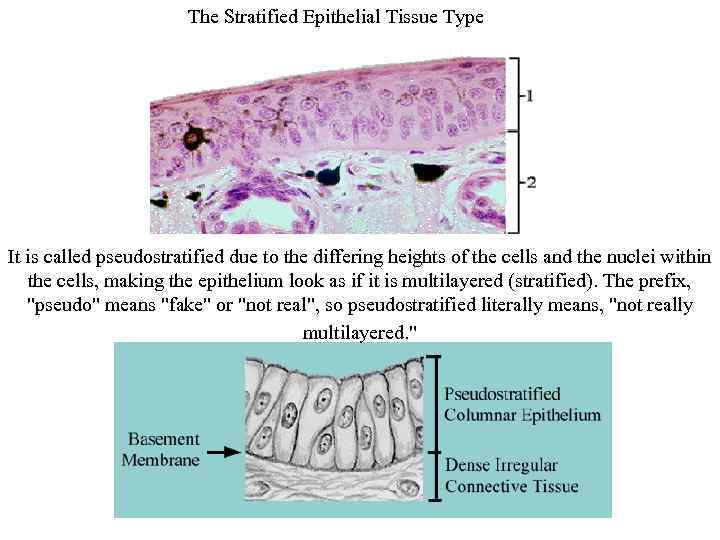 The Stratified Epithelial Tissue Type It is called pseudostratified due to the differing heights