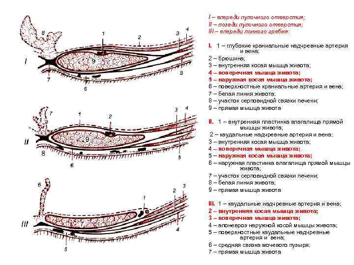 I – впереди пупочного отверстия; II – позади пупочного отверстия; III – впереди лонного