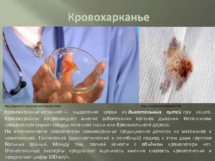 Кровохарканье http: //www. 1 tv. ru/prj/zdorovo/vypusk/22645 http: //med 36. com/symptom/78 Кровохарканье истинное — выделение