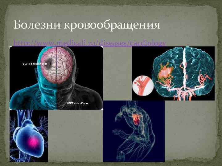 Болезни кровообращения http: //www. medicalj. ru/diseases/cardiology 