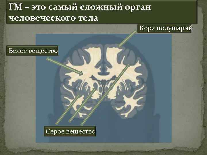 ГМ – это самый сложный орган человеческого тела Кора полушарий Белое вещество Серое вещество