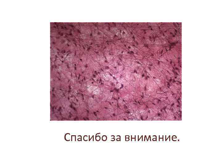 Спасибо за внимание. 