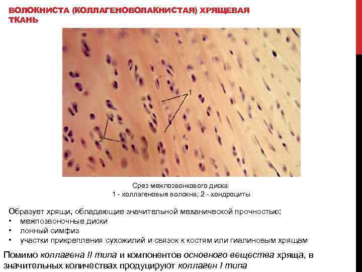 ВОЛОКНИСТА (КОЛЛАГЕНОВОЛАКНИСТАЯ) ХРЯЩЕВАЯ ТКАНЬ Срез межпозвонкового диска: 1 - коллагеновые волокна; 2 - хондроциты