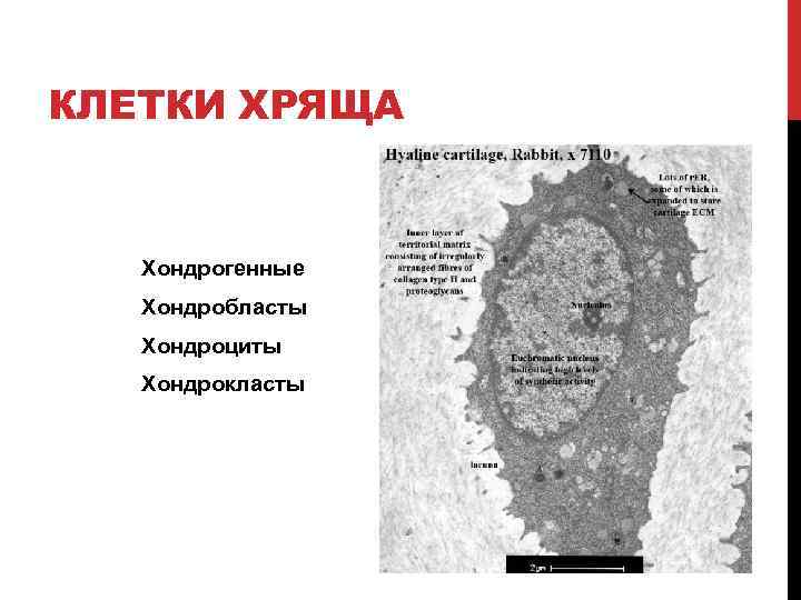 КЛЕТКИ ХРЯЩА Хондрогенные Хондробласты Хондроциты Хондрокласты 