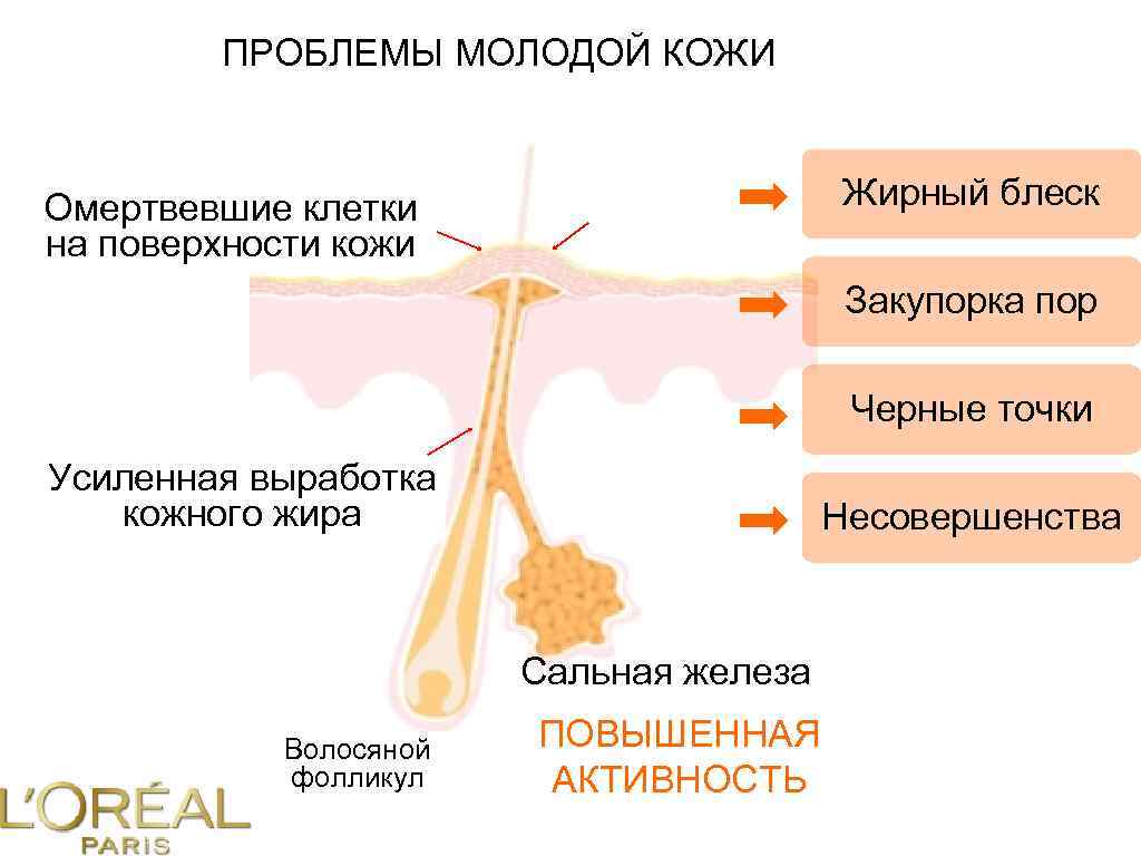 ПРОБЛЕМЫ МОЛОДОЙ КОЖИ Жирный блеск Омертвевшие клетки на поверхности кожи Закупорка пор Черные точки