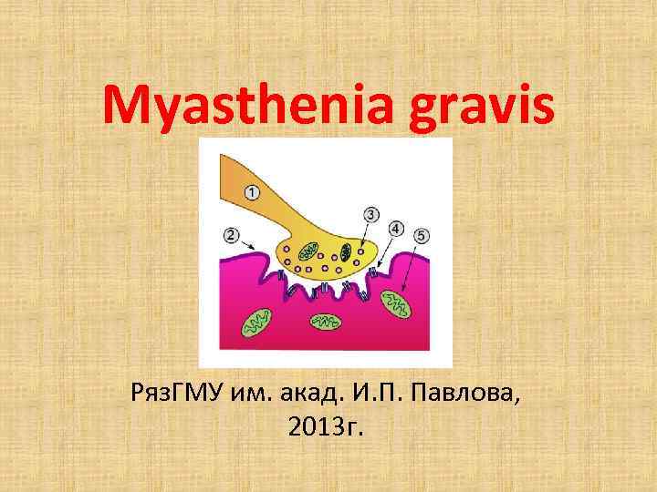 Myasthenia gravis Ряз. ГМУ им. акад. И. П. Павлова, 2013 г. 