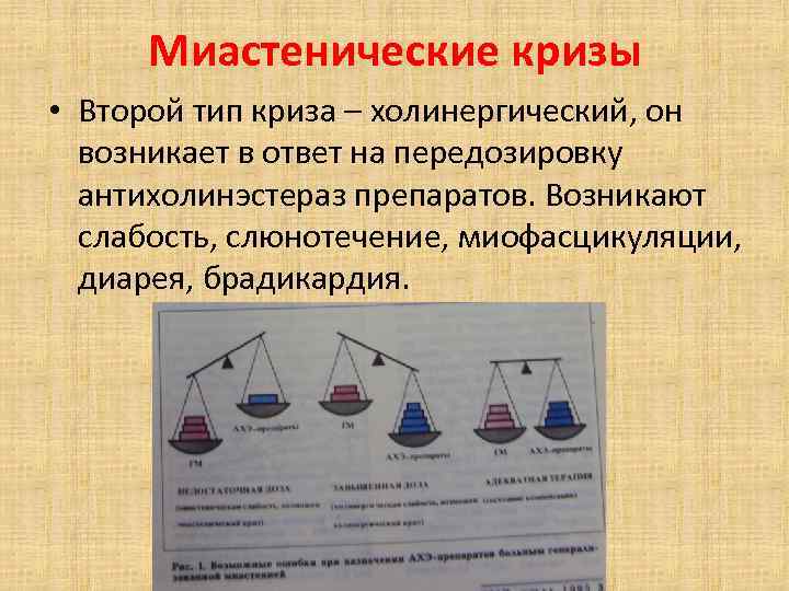 Миастенические кризы • Второй тип криза – холинергический, он возникает в ответ на передозировку