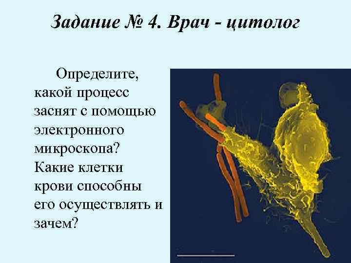 Задание № 4. Врач - цитолог Определите, какой процесс заснят с помощью электронного микроскопа?